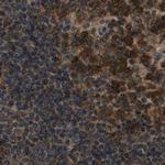 NUDCD3 Antibody in Immunohistochemistry (IHC)