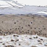 NUDCD3 Antibody in Immunohistochemistry (IHC)