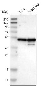 NUDCD3 Antibody in Western Blot (WB)