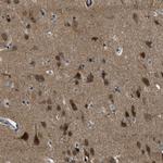 NUDCD3 Antibody in Immunohistochemistry (IHC)