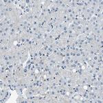 NUDCD3 Antibody in Immunohistochemistry (IHC)