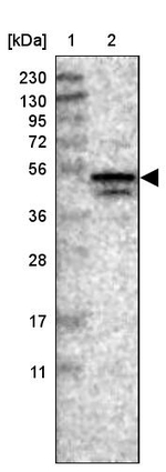 NUDCD3 Antibody in Western Blot (WB)
