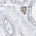 C22orf42 Polyclonal Antibody