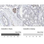 C22orf42 Antibody in Immunohistochemistry (IHC)