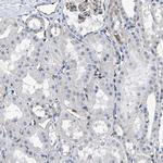 C22orf42 Antibody in Immunohistochemistry (IHC)