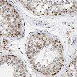 ELAC2 Antibody in Immunohistochemistry (Paraffin) (IHC (P))