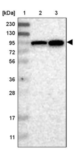 ELAC2 Antibody in Western Blot (WB)