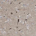 SFXN1 Antibody in Immunohistochemistry (Paraffin) (IHC (P))