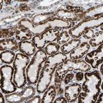 SFXN1 Antibody in Immunohistochemistry (Paraffin) (IHC (P))