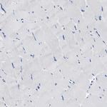 SFXN1 Antibody in Immunohistochemistry (Paraffin) (IHC (P))