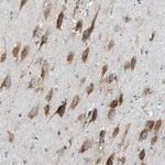 LMBRD1 Polyclonal Antibody