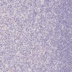 SLC28A1 Antibody in Immunohistochemistry (IHC)