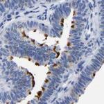 Annexin A13 Antibody in Immunohistochemistry (IHC)