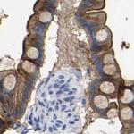 Annexin A13 Antibody in Immunohistochemistry (IHC)