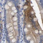 Annexin A13 Antibody in Immunohistochemistry (IHC)