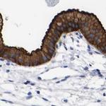 Annexin A13 Antibody in Immunohistochemistry (IHC)