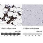 HEMGN Antibody in Immunohistochemistry (IHC)