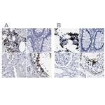 HEMGN Antibody in Immunohistochemistry (IHC)
