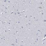HEMGN Antibody in Immunohistochemistry (IHC)