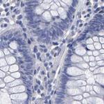 HEMGN Antibody in Immunohistochemistry (IHC)