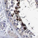 HEMGN Antibody in Immunohistochemistry (IHC)