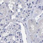 HEMGN Antibody in Immunohistochemistry (IHC)