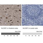 SLC35F1 Antibody in Immunohistochemistry (IHC)