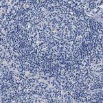 SLC35F1 Antibody in Immunohistochemistry (IHC)