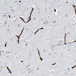 FAM18B Antibody in Immunohistochemistry (Paraffin) (IHC (P))