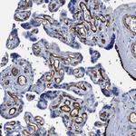 FAM18B Antibody in Immunohistochemistry (Paraffin) (IHC (P))