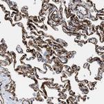 FAM18B Antibody in Immunohistochemistry (IHC)