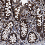 UPF1 Antibody in Immunohistochemistry (Paraffin) (IHC (P))