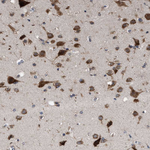 UPF1 Antibody in Immunohistochemistry (Paraffin) (IHC (P))