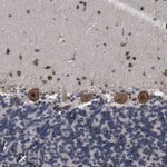 UPF1 Antibody in Immunohistochemistry (Paraffin) (IHC (P))