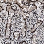 MIER1 Antibody in Immunohistochemistry (Paraffin) (IHC (P))