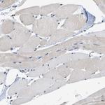MIER1 Antibody in Immunohistochemistry (Paraffin) (IHC (P))