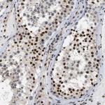 MIER1 Antibody in Immunohistochemistry (Paraffin) (IHC (P))