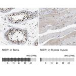 MIER1 Antibody in Immunohistochemistry (IHC)