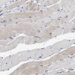 MIER1 Antibody in Immunohistochemistry (IHC)