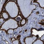 S100A13 Antibody in Immunohistochemistry (IHC)