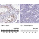 DAZL Antibody in Immunohistochemistry (IHC)