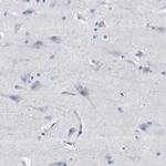 HEMGN Antibody in Immunohistochemistry (Paraffin) (IHC (P))