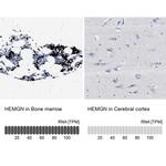 HEMGN Antibody in Immunohistochemistry (IHC)