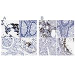 HEMGN Antibody in Immunohistochemistry (IHC)