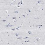 HEMGN Antibody in Immunohistochemistry (IHC)