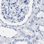 HEMGN Antibody in Immunohistochemistry (IHC)