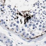 HEMGN Antibody in Immunohistochemistry (IHC)