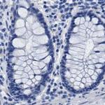 HEMGN Antibody in Immunohistochemistry (IHC)