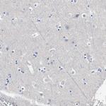 HEMGN Antibody in Immunohistochemistry (Paraffin) (IHC (P))