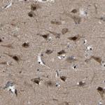 TRIM35 Antibody in Immunohistochemistry (Paraffin) (IHC (P))